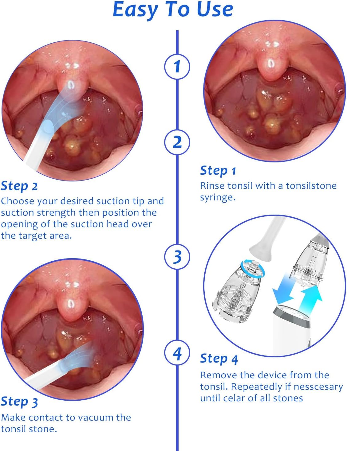 8 Suction Modes 3 Levels Tonsi - Electronics Repair And Maintenance recensione e prezzo